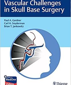 Vascular Challenges in Skull Base Surgery (EPUB)