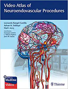 Video Atlas of Neuroendovascular Procedures (EPUB)