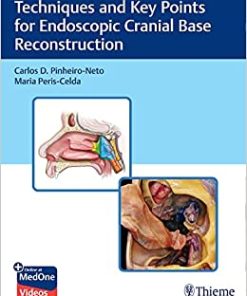 Techniques and Key Points for Endoscopic Cranial Base Reconstruction (EPUB)