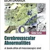 Cerebrovascular Abnormalities: A Book-Atlas of Macroscopic and Microscopic Aspects Research (PDF) Cerebrovascular Abnormalities: A Book-Atlas of Macroscopic and Microscopic Aspects Research (PDF)