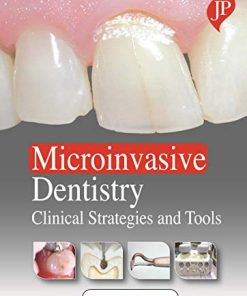 Microinvasive Dentistry: Clinical Strategies and Tools (PDF)