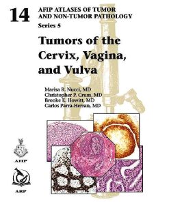 Tumors of the Cervix, Vagina, and Vulva (AFIP Atlas of Tumor Pathology, Series 5) (PDF)