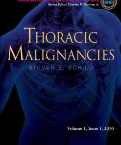 Thoracic Malignancies (EPUB)