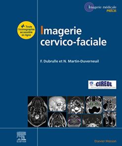 Imagerie cervicofaciale: Massif facial – Sinus – Voies aérodigestives supérieures – Pathologies cervicales – Espaces profonds (Imagerie médicale : Précis) (French Edition) (EPUB)