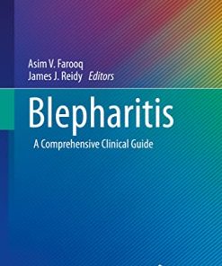 Blepharitis: A Comprehensive Clinical Guide (Essentials in Ophthalmology) (PDF)