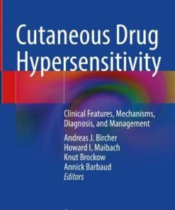 Cutaneous Drug Hypersensitivity: Clinical Features, Mechanisms, Diagnosis, and Management (PDF)