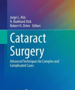 Cataract Surgery: Advanced Techniques for Complex and Complicated Cases (Essentials in Ophthalmology) (PDF)