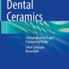 Dental Ceramics: Fracture Mechanics and Engineering Design (PDF)