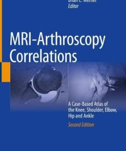 MRI-Arthroscopy Correlations: A Case-Based Atlas of the Knee, Shoulder, Elbow, Hip and Ankle, 2nd Edition (PDF)