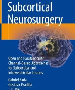 Subcortical Neurosurgery: Open and Parafascicular Channel-Based Approaches for Subcortical and Intraventricular Lesions (PDF)