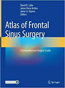 Atlas of Frontal Sinus Surgery: A Comprehensive Surgical Guide (EPUB)