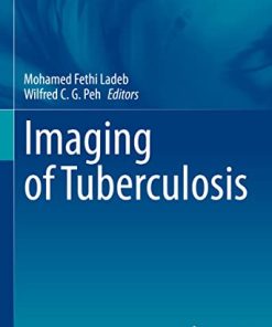 Imaging of Tuberculosis (Medical Radiology) (PDF)