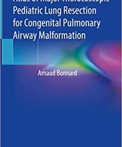 Atlas of Major Thoracoscopic Pediatric Lung Resection for Congenital Pulmonary Airway Malformation (PDF)