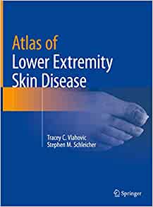 Atlas of Lower Extremity Skin Disease (PDF)