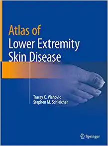 Atlas of Lower Extremity Skin Disease (EPUB)