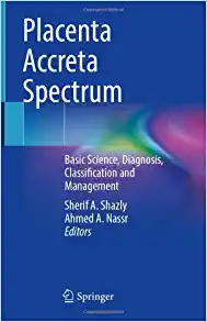 Placenta Accreta Spectrum: Basic Science, Diagnosis, Classification and Management (PDF)