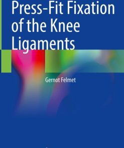 Press-Fit Fixation of the Knee Ligaments (PDF)