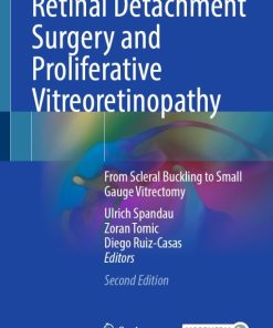 Retinal Detachment Surgery and Proliferative Vitreoretinopathy, 2nd Edition (PDF)