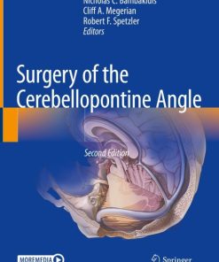 Surgery of the Cerebellopontine Angle, 2nd Edition (EPUB)