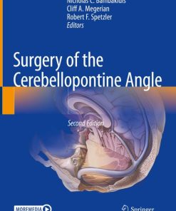 Surgery of the Cerebellopontine Angle, 2nd Edition (PDF)