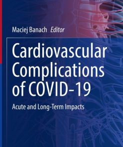 Cardiovascular Complications of COVID-19 (EPUB)