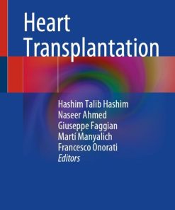 Heart Transplantation (EPUB)