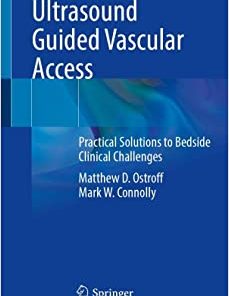 Ultrasound Guided Vascular Access: Practical Solutions to Bedside Clinical Challenges (PDF)