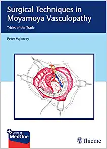 Surgical Techniques in Moyamoya Vasculopathy: Tricks of the Trade (EPUB)