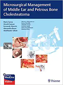 Microsurgical Management of Middle Ear and Petrous Bone Cholesteatoma (EPUB)