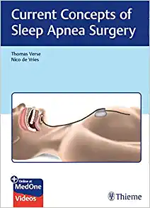 Current Concepts of Sleep Apnea Surgery (EPUB)