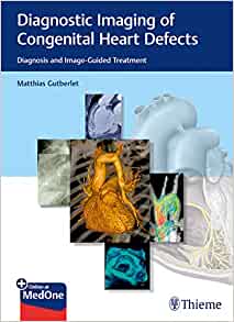 Diagnostic Imaging of Congenital Heart Defects: Diagnosis and Image-Guided Treatment (EPUB)