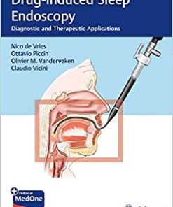 Drug-Induced Sleep Endoscopy: Diagnostic and Therapeutic Applications (EPUB)