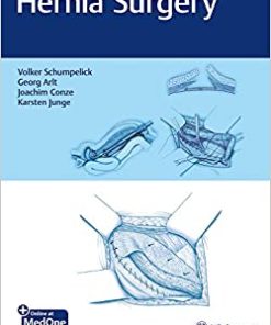 Hernia Surgery (EPUB)