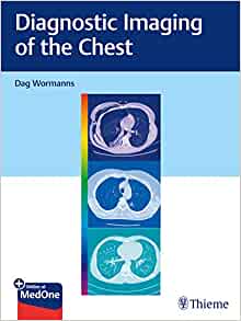 Diagnostic Imaging of the Chest (EPUB)