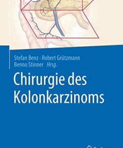 Chirurgie des Kolonkarzinoms (German Edition) (PDF)