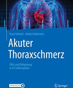 Akuter Thoraxschmerz: EKGs und Bildgebung in 65 Fallbeispielen (German Edition) (PDF)