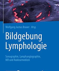 Bildgebung Lymphologie: Sonographie, Lymphangiographie, MR und Nuklearmedizin (German Edition) (PDF)