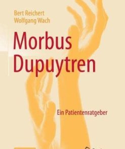 Morbus Dupuytren: Ein Patientenratgeber (German Edition) (PDF)