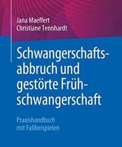 Schwangerschaftsabbruch und gestörte Frühschwangerschaft: Praxishandbuch mit Fallbeispielen (German Edition) (PDF)