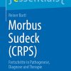 Morbus Sudeck (CRPS): Fortschritte in Pathogenese, Diagnose und Therapie (essentials) (German Edition) (EPUB)