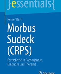 Morbus Sudeck (CRPS): Fortschritte in Pathogenese, Diagnose und Therapie (essentials) (German Edition) (EPUB)