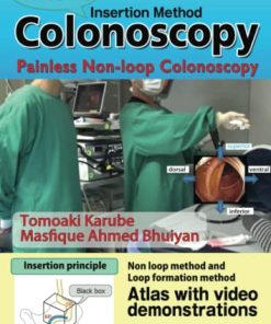 Dr. Carl’s Colonoscopy Insertion Method: Painless Non-loop Colonoscopy (AZW3 + EPUB + Converted PDF)