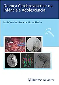 Doença Cerebrovascular na Infância e Adolescência (PDF)