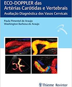 ECO-DOPPLER das Artérias Carótidas e Vertebrais: Avaliação Diagnóstica dos Vasos Cervicais (PDF)