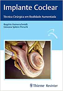 Implante Coclear: Técnicas Cirúrgica em Realidade Aumentada (PDF)