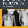 Radiología pediátrica en urgencias (PDF)