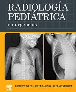 Radiología pediátrica en urgencias (PDF)