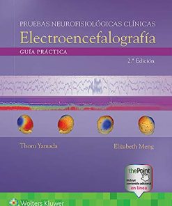 Pruebas neurofisiológicas clínicas. Electroencefalografía: Guía práctica, 2e (Spanish Edition) (EPUB)