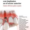 Tratamientos restauradores con implantes en el sector anterior. Casos clínicos paso a paso. (EPUB) Tratamientos restauradores con implantes en el sector anterior. Casos clínicos paso a paso. (EPUB)