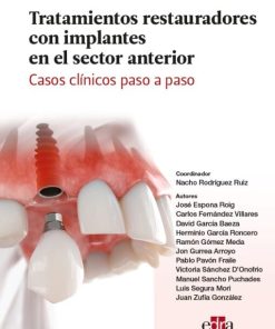 Tratamientos restauradores con implantes en el sector anterior. Casos clínicos paso a paso. (EPUB)